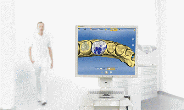 CEREC 디지털 체어사이드 시스템